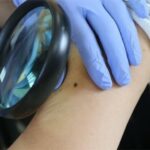 1091357-cancer-de-piel-minsa-recomienda-acudir-al-establecimiento-de-salud-en-caso-de-presentar-manchas-bultos-y-lesiones-en-la-piel