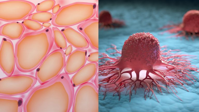 La grasa, componente clave en un posible tratamiento oncológico